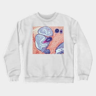 Dermoid ovarian cyst, light micrograph (C019/9256) Crewneck Sweatshirt